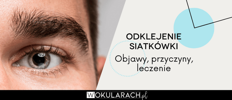 Odklejenie siatkówki – objawy, przyczyny, leczenie