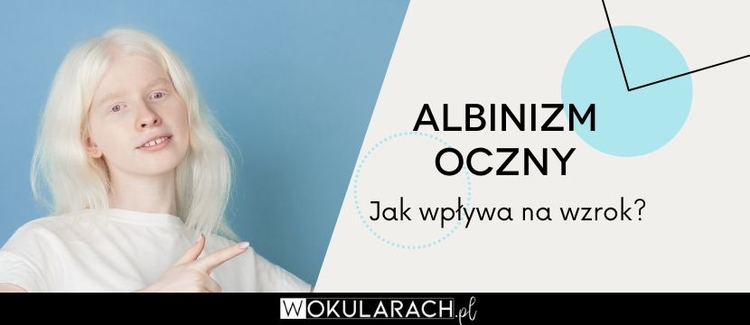 Albinizm oczny – jak wpływa na wzrok?