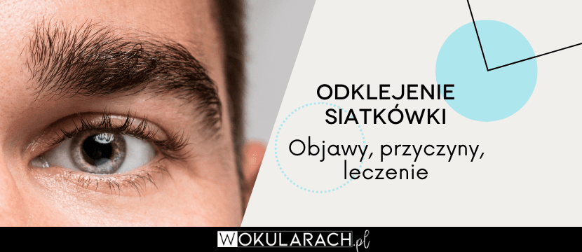 Odklejenie siatkówki – objawy, przyczyny, leczenie